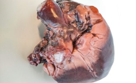 heart